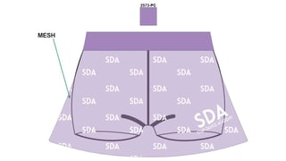 Starda C T mesh skort purple